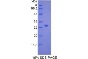 SDS-PAGE of Protein Standard from the Kit (Highly purified E. (alpha 2 Macroglobulin ELISA 试剂盒)