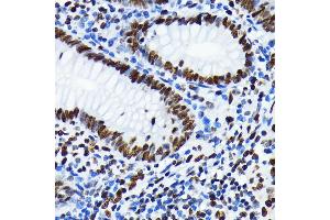 Immunohistochemistry of paraffin-embedded human appendix using Acetyl-Histone H4-K5 antibody (ABIN7267743) at dilution of 1:100 (40x lens).