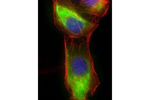 Immunofluorescent analysis of 4 % paraformaldehyde-fixed, 0. (Vimentin 抗体  (AA 63-90))