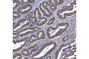 IHC analysis of TRMT6 using anti-TRMT6 antibody (ABIN7602138). (TRMT6 抗体  (AA 6-489))