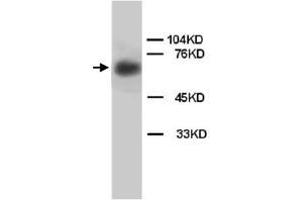 Western Blot analysis of LMNB1 expression from rat brain tissue lyate with LMNB1 polyclonal antibody . (Lamin B1 抗体  (C-Term))
