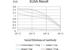 Black line: Control Antigen (100 ng),Purple line: Antigen (10 ng), Blue line: Antigen (50 ng), Red line:Antigen (100 ng) (CTNNB1 抗体  (AA 632-781))