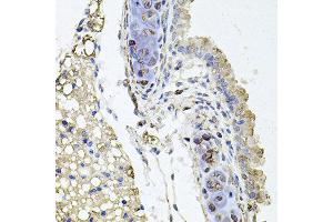 Immunohistochemistry of paraffin-embedded mouse lung using RHOT1 antibody at dilution of 1:100 (x40 lens). (RHOT1 抗体)