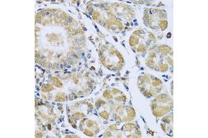 Immunohistochemistry of paraffin-embedded human stomach using PMPCB antibody (ABIN5972414) at dilution of 1/100 (40x lens). (PMPCB 抗体)
