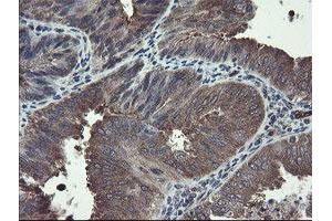 Image no. 5 for anti-TSC22 Domain Family, Member 1 (TSC22D1) antibody (ABIN1501535)