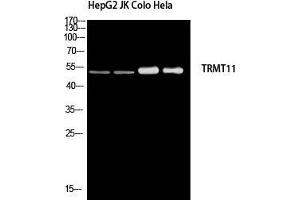 Western Blot (WB) analysis of HepG2 JK Colo HeLa using TRMT11 antibody. (Trmt11 抗体)
