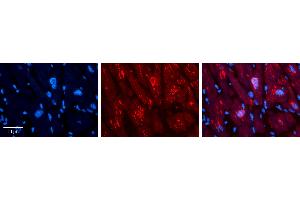 Rabbit Anti-MLX Antibody   Formalin Fixed Paraffin Embedded Tissue: Human heart Tissue Observed Staining: Cytoplasmic, nucleus Primary Antibody Concentration: N/A Other Working Concentrations: 1:600 Secondary Antibody: Donkey anti-Rabbit-Cy3 Secondary Antibody Concentration: 1:200 Magnification: 20X Exposure Time: 0. (MLX 抗体  (C-Term))