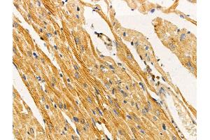ABIN6258718 and ABIN6274421 at 1/100 staining Rat heart tissue by IHC-P. (TUSC5 抗体  (N-Term))