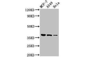 Western Blot Positive WB detected in: MCF-7 whole cell lysate, A549 whole cell lysate, Hela whole cell lysate All lanes: TMEM59 antibody at 3 μg/mL Secondary Goat polyclonal to rabbit IgG at 1/50000 dilution Predicted band size: 37 kDa Observed band size: 37 kDa (TMEM59 抗体  (AA 59-201))