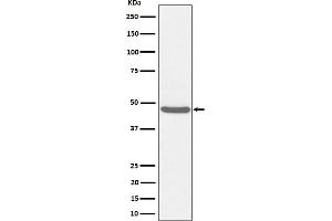 Western blot analysis of BCKDK expression in HeLa cell lysate.