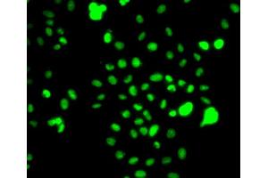 Immunofluorescence analysis of MCF7 cell using CEBPG antibody. (CEBPG 抗体)