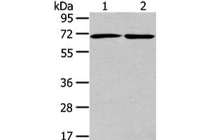 Western Blot analysis of A431 and hela cell using ARFGAP2 Polyclonal Antibody at dilution of 1/200 (arfgap2 抗体)