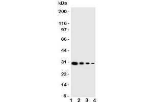 Western blot testing of LTK antibody and human recombinant protein;  Lane 1: 10ng;   2: 5ng;  3: 2. (LTK 抗体  (C-Term))