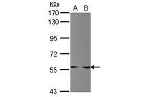 Image no. 1 for anti-Phosphoribosyl Pyrophosphate Amidotransferase (PPAT) (AA 283-517) antibody (ABIN1500359) (PPAT 抗体  (AA 283-517))