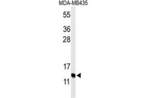 Western Blotting (WB) image for anti-Gonadotropin-Releasing Hormone 2 (GnRH2) antibody (ABIN3004318) (GnRH2 抗体)