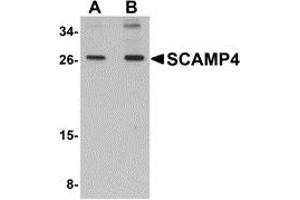 Western Blotting (WB) image for anti-Secretory Carrier Membrane Protein 4 (SCAMP4) (C-Term) antibody (ABIN1030644) (SCAMP4 抗体  (C-Term))