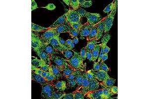 Immunofluorescence (IF) image for anti-Proteasome (Prosome, Macropain) Subunit, beta Type, 1 (PSMB1) (AA 214-241), (C-Term) antibody (ABIN652802)