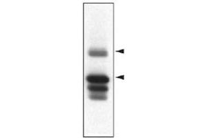 Western blot analysis of Ptpn5 in striatal rat protein homogenates using Ptpn5 monoclonal antibody, clone 23E5  . (PTPN5 抗体  (AA 57-74))
