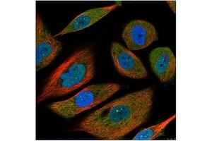 Image no. 1 for anti-Interleukin 6 (IL6) antibody (ABIN181728) (IL-6 抗体)