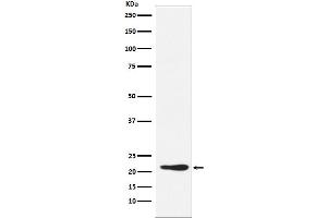 Western blot analysis of GDF3 expression in 293T cell lysate.