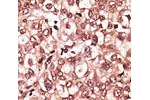 Immunohistochemistry (IHC) image for anti-Toll-Like Receptor 6 (TLR6) (AA 393-423) antibody (ABIN3029174)