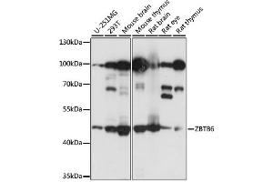 Western blot analysis of extracts of various cell lines, using ZBTB6 antibody. (ZBTB6 抗体)