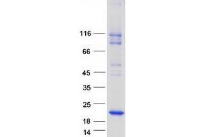 Western Blotting (WB) image for MARVEL Domain Containing 1 (MARVELD1) protein (Myc-DYKDDDDK Tag) (ABIN2725530)