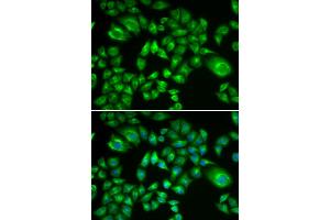 Immunofluorescence analysis of A549 cells using H6PD antibody.