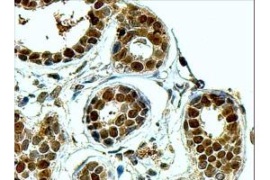 ABIN184704 (4µg/ml) staining of paraffin embedded Human Breast. (APEX1 抗体  (N-Term))