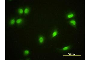 Immunofluorescence of monoclonal antibody to CRY1 on HeLa cell.