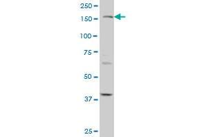 TEK monoclonal antibody (M02), clone 3F8 Western Blot analysis of TEK expression in A-431 . (TEK 抗体  (AA 701-800))