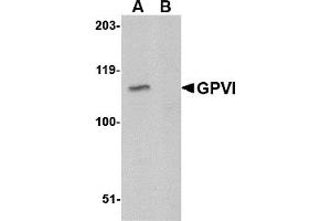 Western Blotting (WB) image for anti-Glycoprotein VI (Platelet) (GP6) (C-Term) antibody (ABIN1030419) (GP6 抗体  (C-Term))
