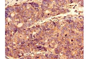 Immunocytochemistry (ICC) image for anti-CTP Synthase II (CTPS2) (AA 62-315) antibody (ABIN7148718)