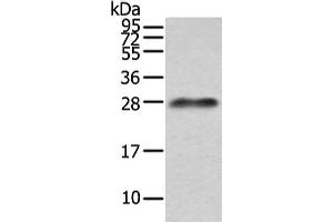 Gel: 12 % SDS-PAGE, Lysate: 40 μg, Lane: Human plasma solution, Primary antibody: ABIN7191260(Lambda Light chain Antibody) at dilution 1/200 dilution, Secondary antibody: Goat anti rabbit IgG at 1/8000 dilution, Exposure time: 10 seconds (IGLV1-51 抗体)