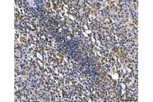 IHC analysis of Thymidylate Synthase/TYMS using anti-Thymidylate Synthase/TYMS antibody (ABIN7599260).