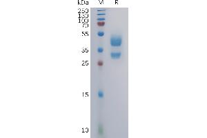 SDS-PAGE (SDS) image for Chemokine (C-X-C Motif) Receptor 3 (CXCR3) (AA 1-53) protein (mFc Tag) (ABIN7491147)