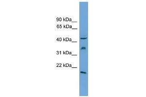 WB Suggested Anti-DUSP5 Antibody Titration: 0. (DUSP5 抗体  (Middle Region))