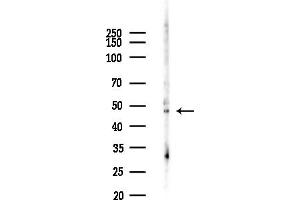 anti-RNA-Binding Protein NOB1 (NOB1) (C-Term) antibody