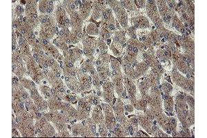 Immunohistochemical staining of paraffin-embedded Human liver tissue using anti-CHN1 mouse monoclonal antibody. (CHN1 抗体)