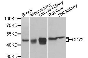 Western blot analysis of extracts of various cell lines, using CD72 antibody. (CD72 抗体  (AA 120-359))