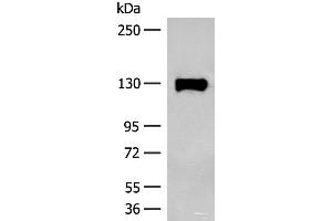 Western blot analysis of Human prostate tissue lysate using SENP6 Polyclonal Antibody at dilution of 1:200 (SENP6 抗体)