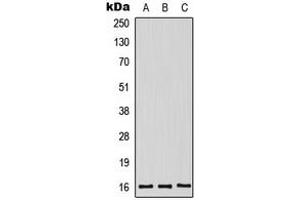 Western blot analysis of Midkine expression in HeLa (A), HepG2 (B), mouse kidney (C) whole cell lysates. (Midkine 抗体  (Center))