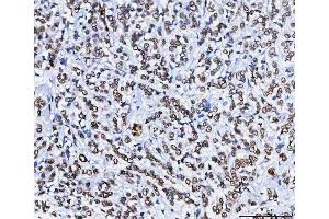 IHC analysis of HnRNP H/HNRNPH1 using anti-HnRNP H/HNRNPH1 antibody (ABIN4886623). (HNRNPH1 抗体  (N-Term))