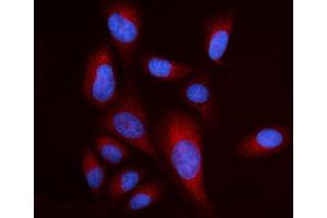 IF analysis of RPL17 using anti-RPL17 antibody (ABIN7601639). (RPL17 抗体  (AA 40-167))