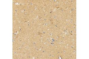 anti-Stathmin-Like 2 (STMN2) (AA 23-170) antibody