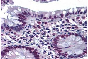 Human Colon: Formalin-Fixed, Paraffin-Embedded (FFPE) (CHEK2 抗体  (AA 1-544))