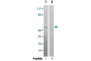 Western blot analysis of extracts from HepG2 cells, using UBXN11 polyclonal antibody . (UBXN11 抗体)