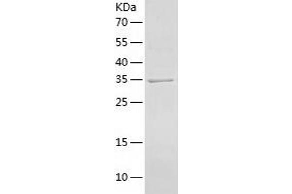 MPST Protein (AA 1-297) (His tag)