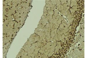 ABIN6276815 at 1/100 staining Mouse brain tissue by IHC-P. (POLB 抗体  (C-Term))