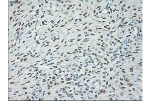 Immunohistochemical staining of paraffin-embedded colon tissue using anti-USP13mouse monoclonal antibody. (USP13 抗体)
